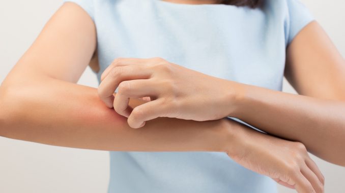 Itching In A Woman