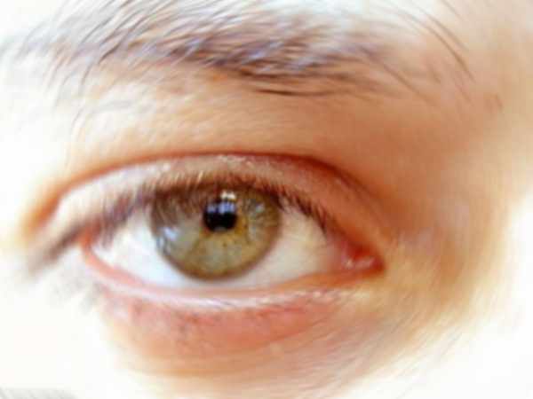 palpebra gonfia, dolorante e arrossata rimedi palpebra gonfia, dolorante e arrossata rimedi