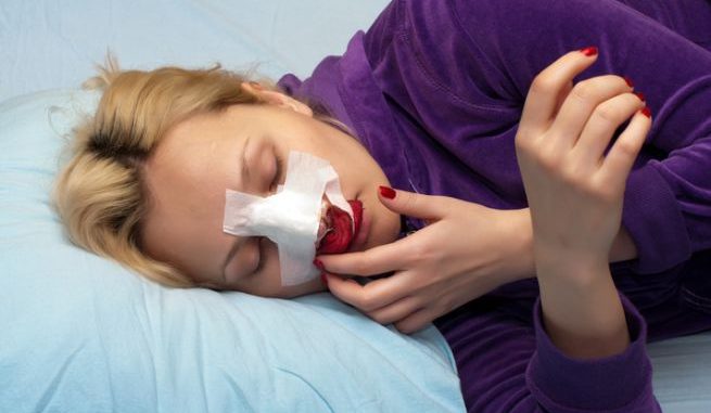 setto-nasale-deviato-operazione