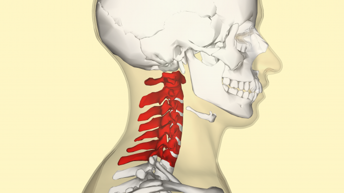 Cervicale: sintomi, rimedi e cura cervicale