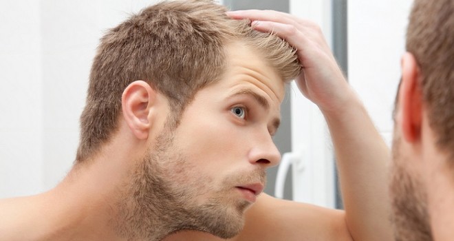 Alopecia seborroica e minoxidil: risultati, effetti collaterali, prezzi Alopecia seborroica e minoxidil: risultati, effetti collaterali, prezzi