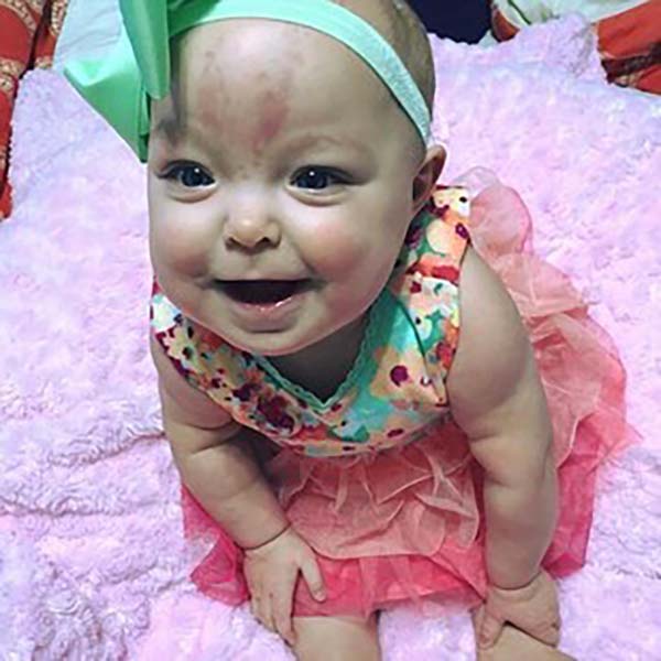 Storie straordinarie, la bambina nata con una lingua da adulto Storie straordinarie, la bambina nata con una lingua da adulto