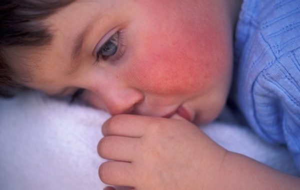 ill-child-alamy-1356912287