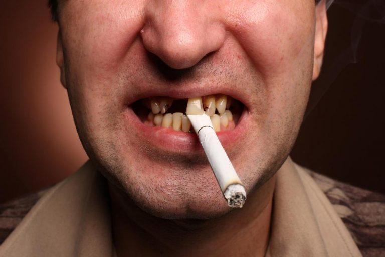il-fumo-tutti-i-danni-e-i-problemi-al-corpo-umano Il fumo tutti i danni e i problemi al corpo umano