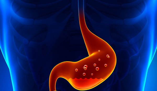 reflusso-gastroesofageo-sintomi-dieta-rimedi-naturali