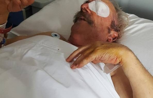 Anziano perde un occhio per i colpi di pistola di un poliziotto
