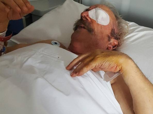 Anziano perde un occhio per i colpi di pistola di un poliziotto
