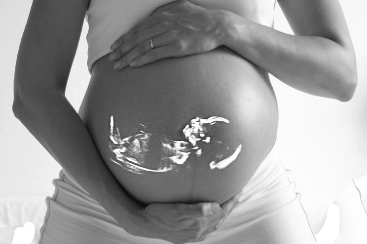 pregnant-518793_960_720-740x493