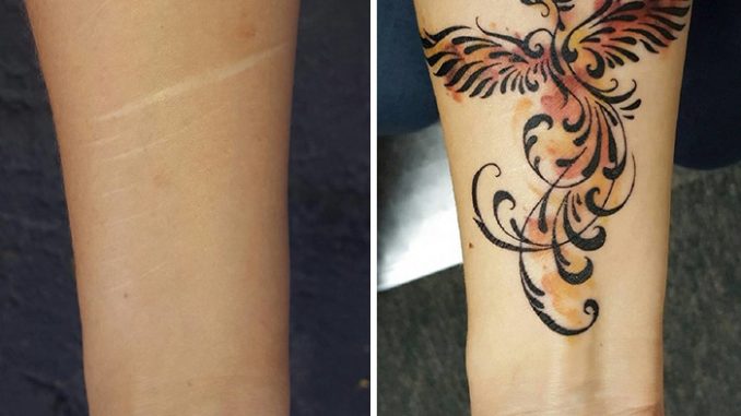 Come coprire una cicatrice con un tatuaggio Come coprire una cicatrice con un tatuaggio