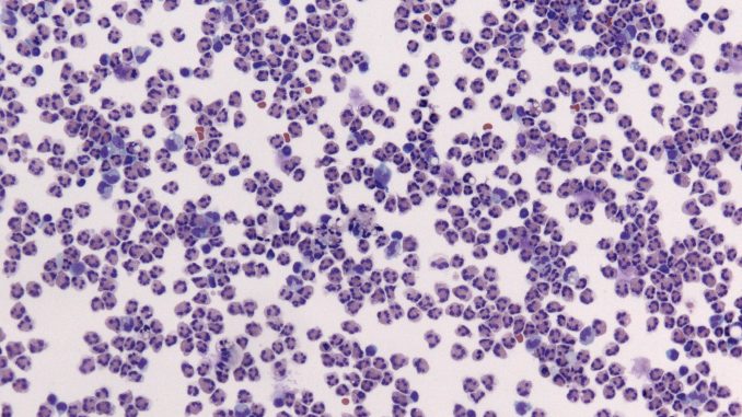 meningite meningite