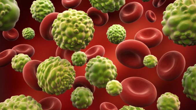 Aloe vera, un alleato nella cura del cancro Aloe vera, un alleato nella cura del cancro