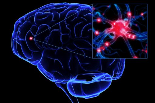 Ictus ischemico: conseguenze, terapia, riabilitazione Ictus ischemico: conseguenze, terapia, riabilitazione