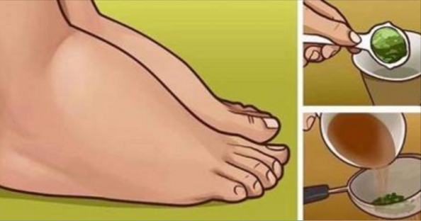 Piedi e caviglie gonfi: cause e rimedi semplici Piedi e caviglie gonfi: cause e rimedi semplici