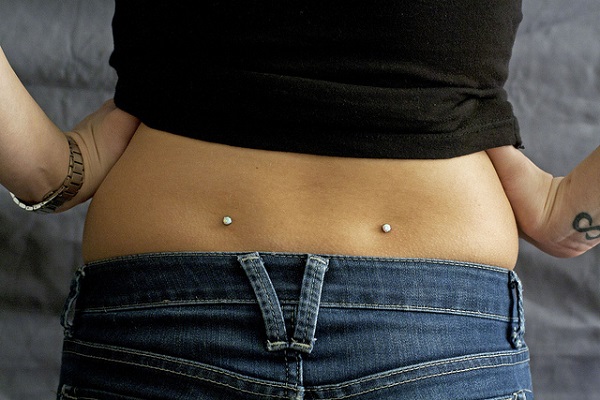 FOSSETTE DI VENERE CON DERMAL. FOSSETTE DI VENERE CON DERMAL.