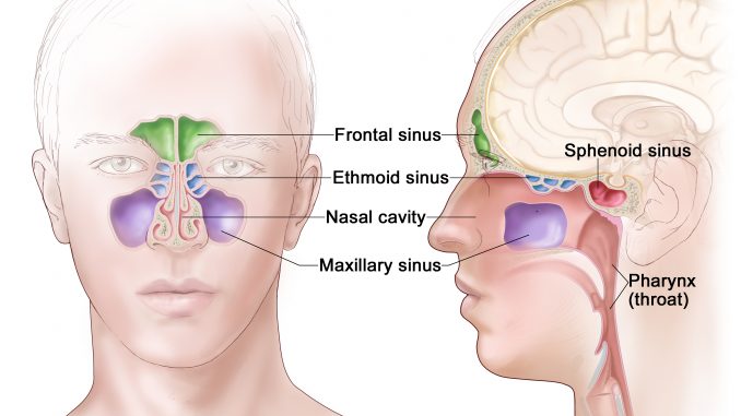 Sinusite: cinque segni per riconoscerla Sinusite: cinque segni per riconoscerla
