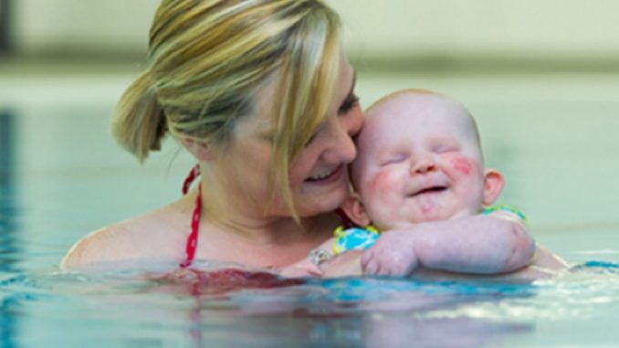 Bimba nasce senza occhi e quando entra in piscina sorride sempre Bimba nasce senza occhi e quando entra in piscina sorride sempre
