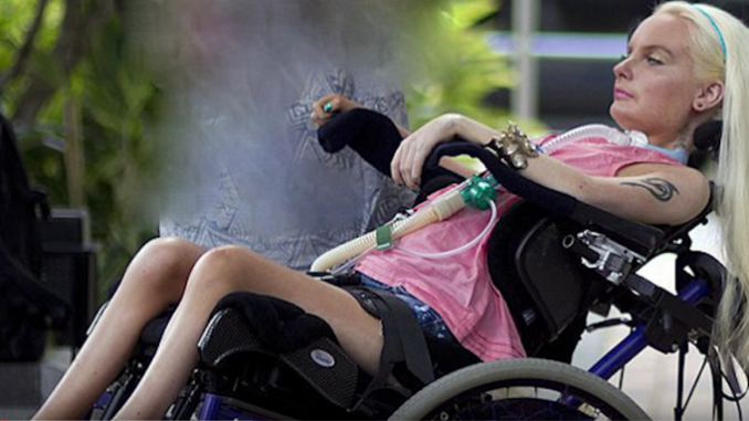 Ragazza paraplegica vive e si veste come Barbie Barbie