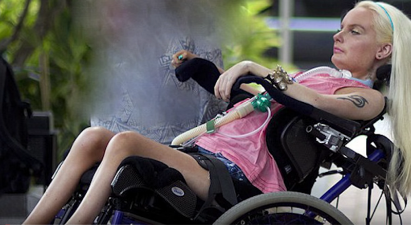 Ragazza paraplegica vive e si veste come Barbie