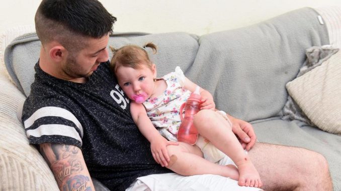 Sandali di gomma distruggono i piedi a una bambina. Le foto bambina