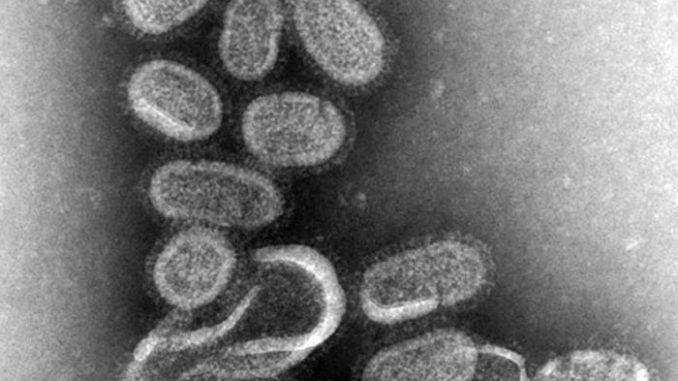 EM_of_influenza_virus