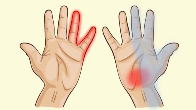 Mani indicatori dello stato di salute. Come capirlo Mani indicatori dello stato di salute. Come capirlo