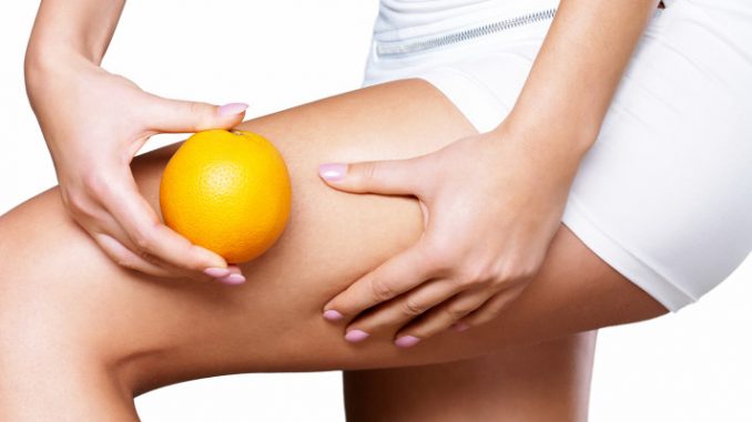 Buchi da cellulite: rimedi chirurgici Buchi da cellulite: rimedi chirurgici