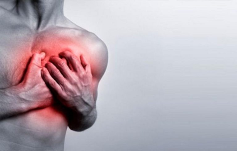 Infarto: come salvare qualcuno nei primi momenti Infarto: come salvare qualcuno nei primi momenti