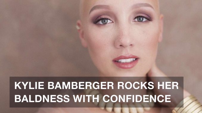 Kylie Bamberger la donna malata di alopecia che si sposa senza parrucca alopecia