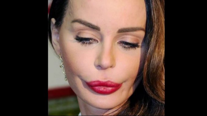Nina Moric rimuove acidi e cortisone le foto