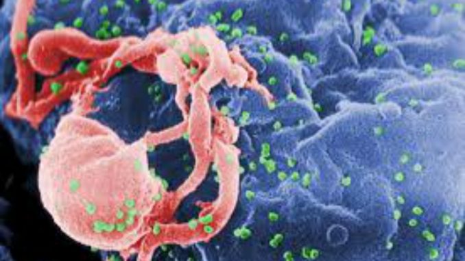 hiv hiv