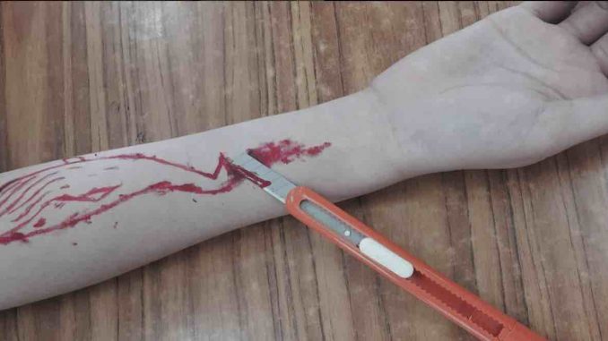 Blue Whale, 4 casi sospetti a Milano: procura apre inchiesta Blue Whale