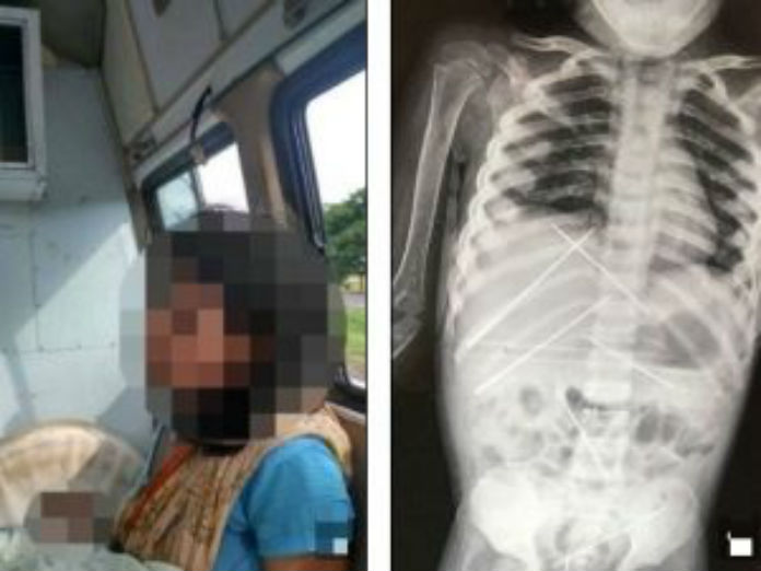 Aghi sparati sui passanti, cinque feriti a Torino Aghi sparati sui passanti, cinque feriti a Torino