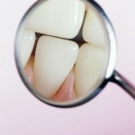 effect vinegar tooth enamel 800x800 150x150
