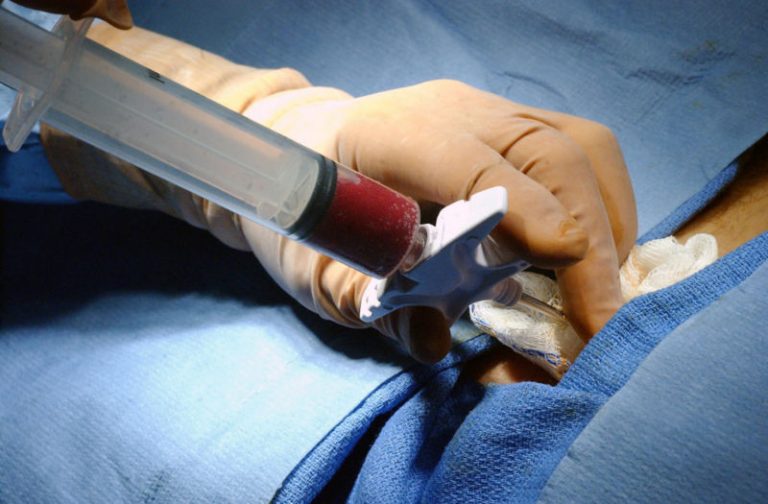 leucemia