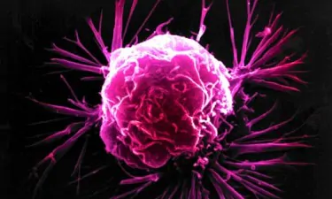 A breast cancer cell 007