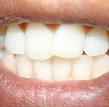 article page main ehow images a04 jr r4 whiten one s teeth 800x800