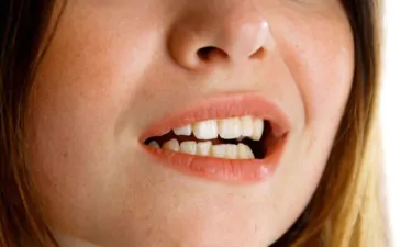 Girl grinding her teeth 007