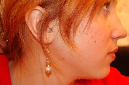 article new ehow images a06 aa 81 home remedies rid face redness 1.1 800x800