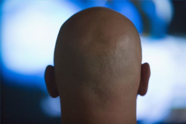 article new ehow images a02 0m 1s use rosemary treat hair loss 800x800
