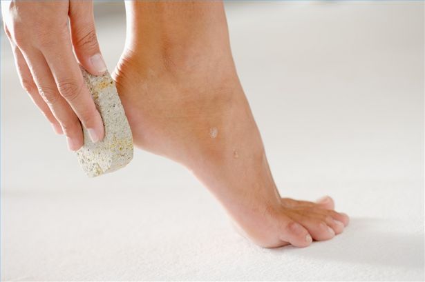 article new ehow images a02 2s ah exfoliate heels 800x800