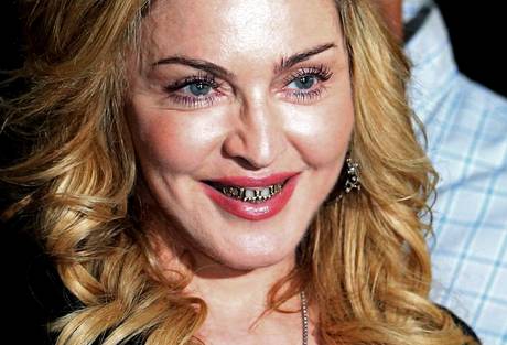 madonna denti