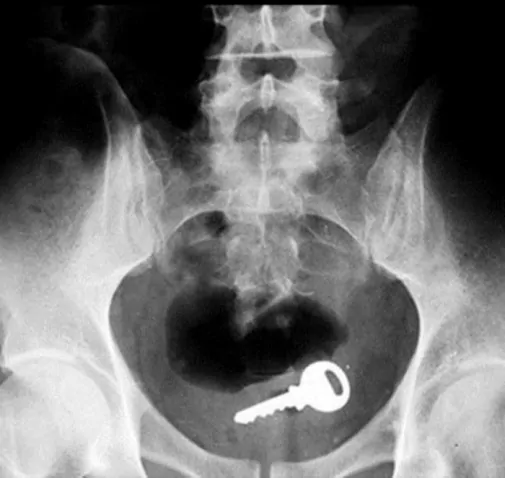 a98446 key butt xray