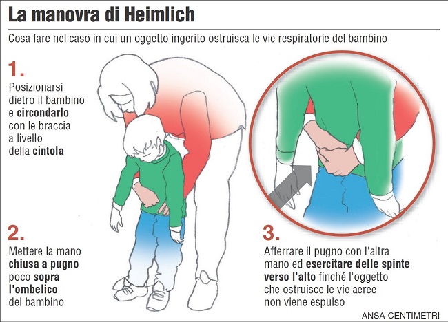 manovra-di-Heimlich