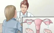 670px Recognize the Symptoms of Polycystic Ovary Syndrome Step 3