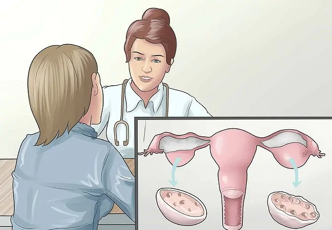 670px Recognize the Symptoms of Polycystic Ovary Syndrome Step 3