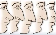 forma del naso
