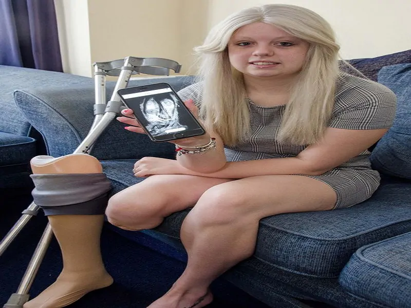 PAY Natalie Turner leg amputation Tumour