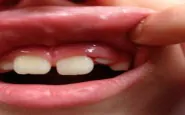 teeth 654457 960 720