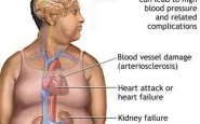 article new ehow images a04 op g6 heart disease caused obesity 800x800