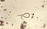 Larva Hookworm: cos'è e cosa provoca